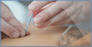 Formation en acupuncture : les critères de sélection